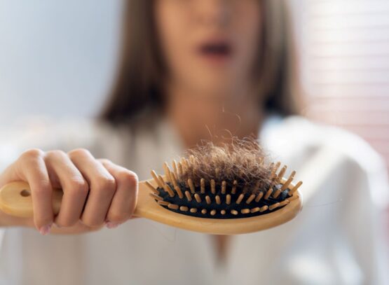 chute de cheveux après les vacances