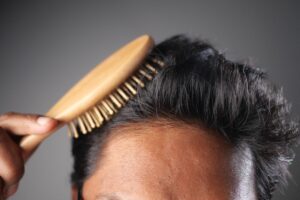 pour éviter la chute de cheveux homme il ne faut pas négliger le cuir chevelu